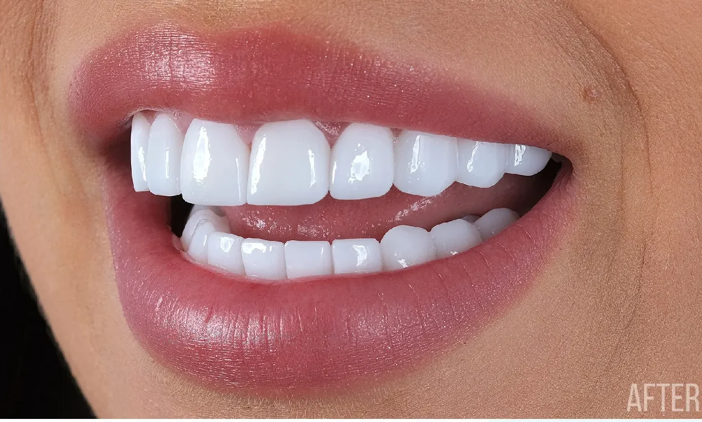 dental-centre-turkey-dct-white-44 dental-centre-turkey-dct-white-44