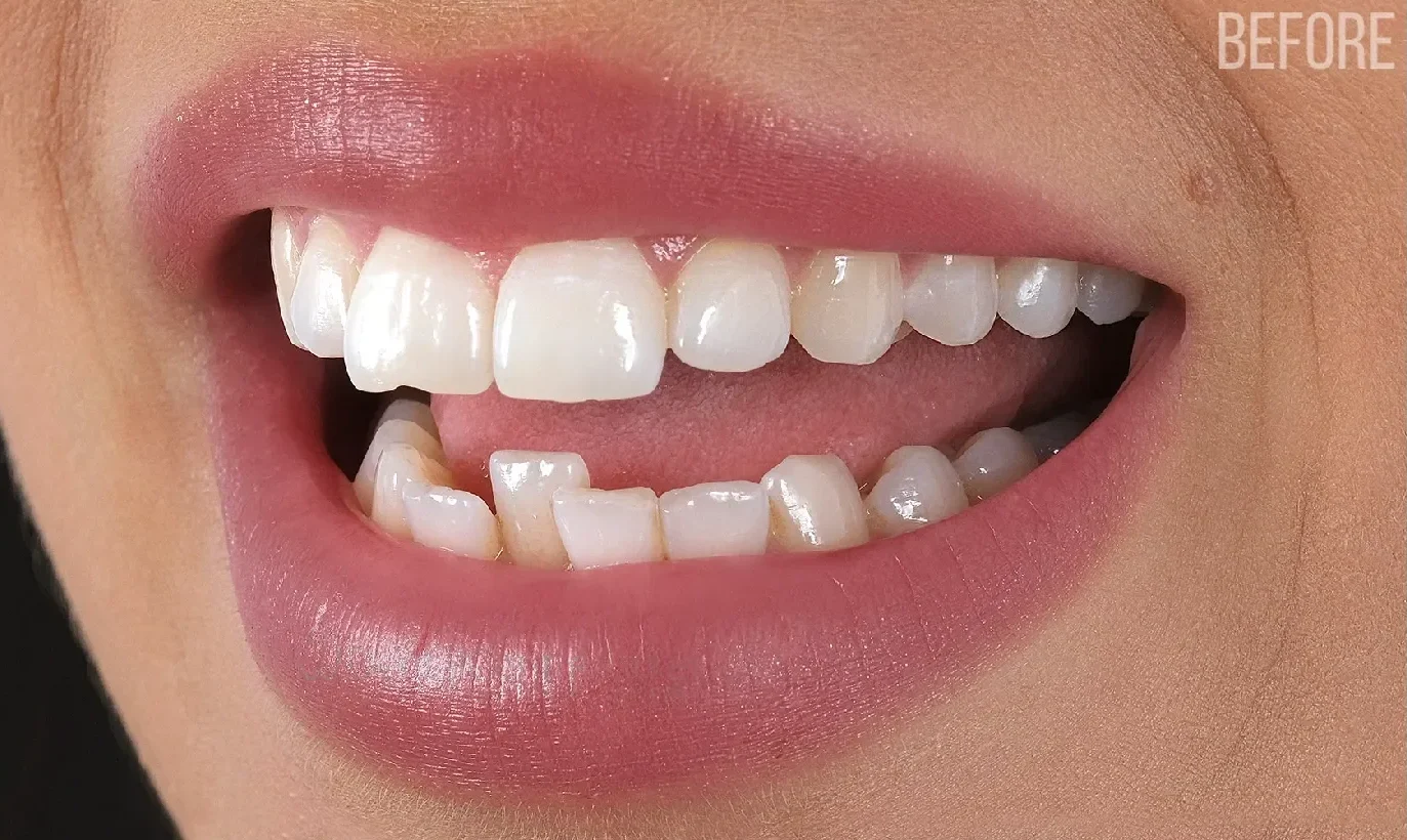 dental-centre-turkey-dct-white-44 dental-centre-turkey-dct-white-44